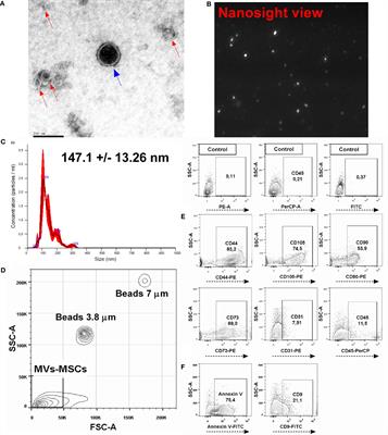 Mesenchymal Stromal Cell-Derived Microvesicles Regulate an Internal Pro-Inflammatory Program in Activated Macrophages